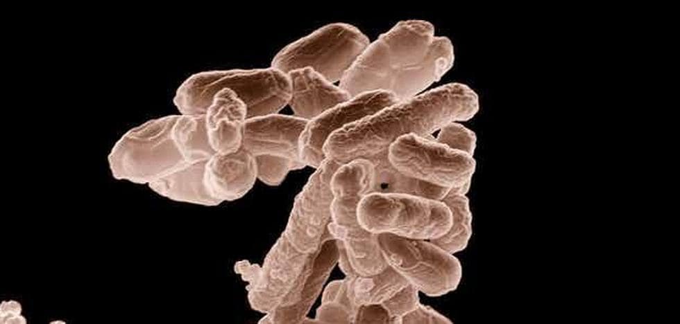¿Qué enfermedades pueden provocar la muerte debido a las bacterias multirresistentes?